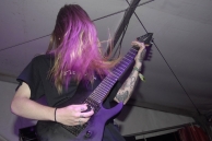 VULVODYNIA